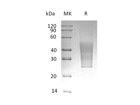 Recombinant Human CD99L2 (C-6His)