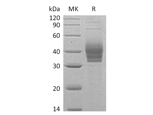 Recombinant Human Cerberus1 (C-6His)
