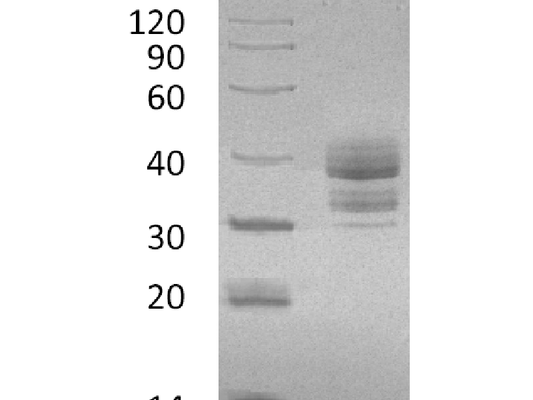 Recombinant Human CGREF1 (C-6His)