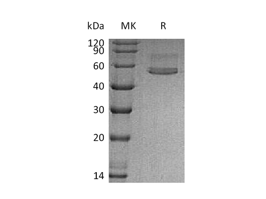Recombinant Human CHIT1 (C-6His)
