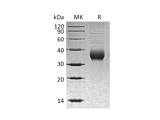 Recombinant Human CHRNB3 (C-6His)