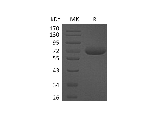 Recombinant Human CFHR5 (C-6His)
