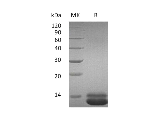 Recombinant Human CXCL1 (C-6His)