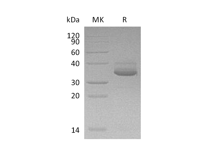 Recombinant Human CXCL10 (C-Fc-6His)