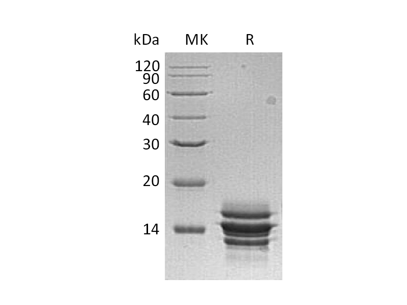 Recombinant Human CXCL7 (C-6His)