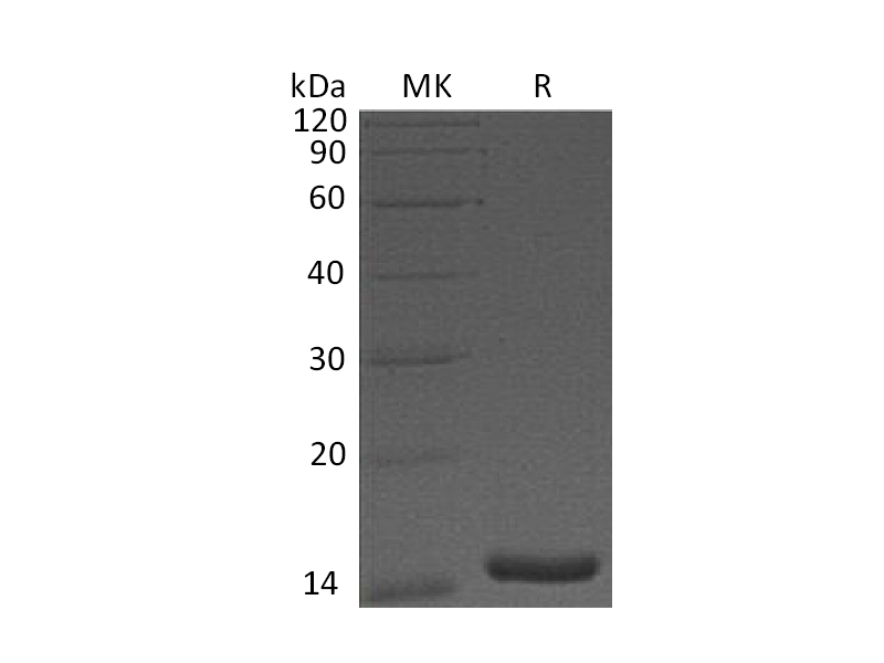 Recombinant Human CST3 (Mammalian)
