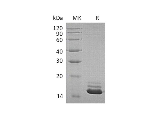 Recombinant Human CST3 (C-6His)
