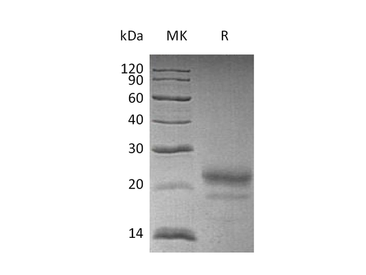 Recombinant Human CST7 (C-6His)