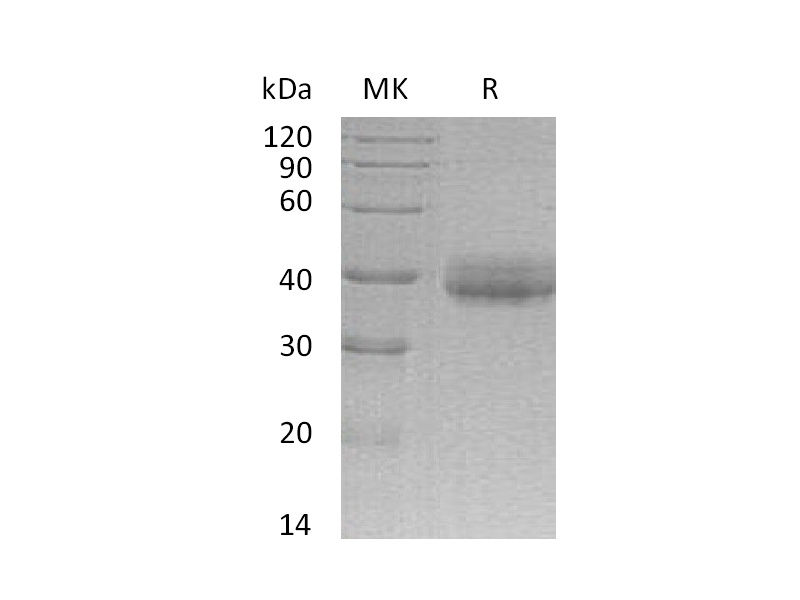 Recombinant Human CRELD2 (C-6His)