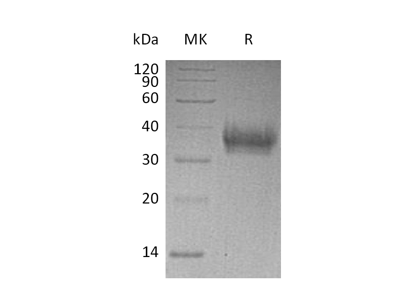 Recombinant Human EPCR (C-6His)