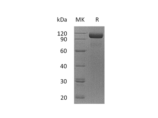 Recombinant Human EGFR vIII  (C-Fc)