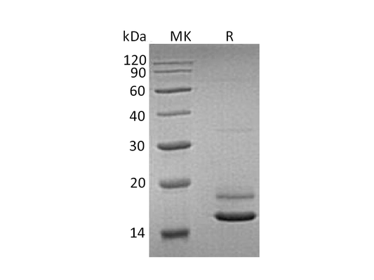 Recombinant Human ERMAP (C-6His)