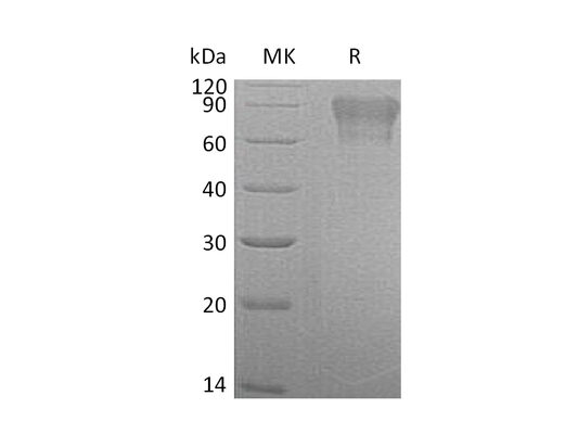 Recombinant Human Factor IX (C-6His)
