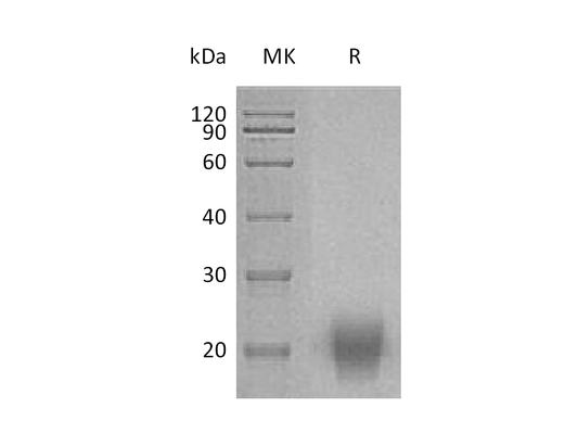 Recombinant Human FSH (C-Flag,C-6His)