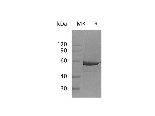 Recombinant Human G6PD (C-6His)
