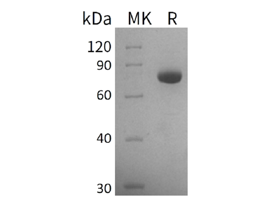 Recombinant Human GALNT3 (C-6His)