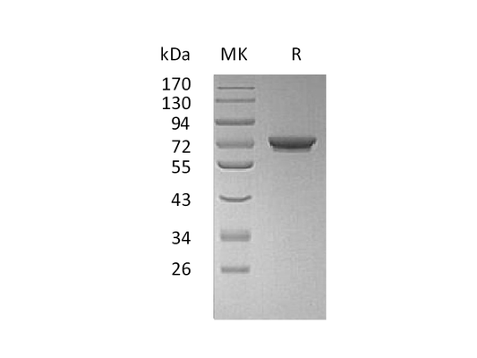 Recombinant Human GALNT7 (C-6His)
