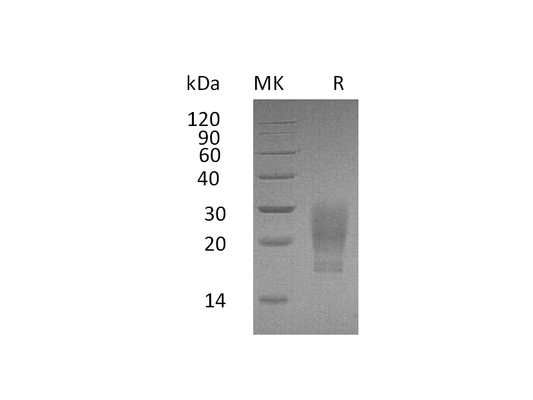 Recombinant Human GM-CSF (C-6His)
