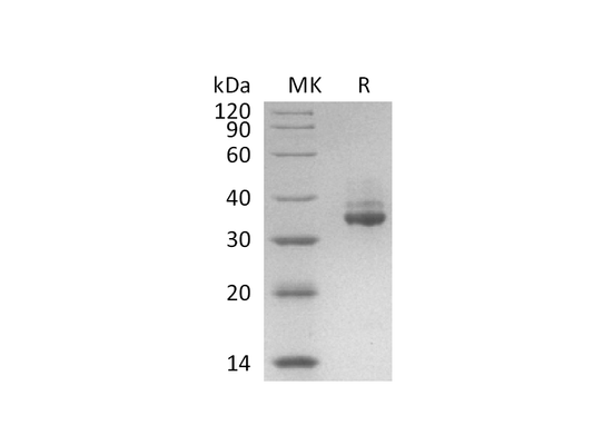 Recombinant Human GPD1 (C-6His)