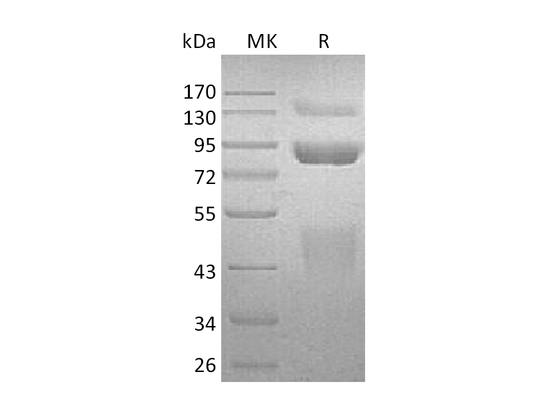 Recombinant Human HGF R (C-6His)