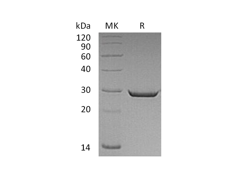 Recombinant Human HMGB2 (C-6His)