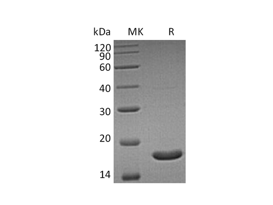 Recombinant Human UBE2B (C-6His)