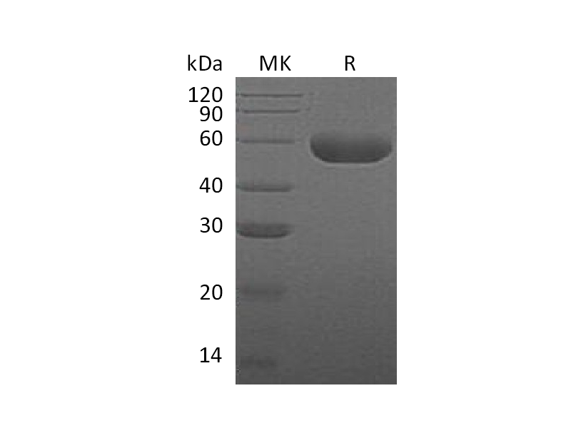 Recombinant Human HYAL1 (C-6His)