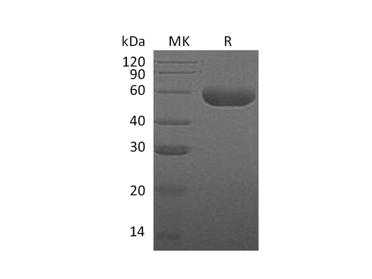 Recombinant Human HYAL1 (C-6His)