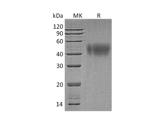 Recombinant Human IFNAR2 (C-6His)