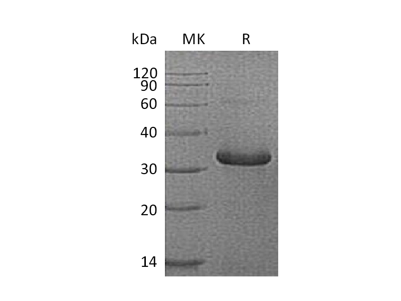 Recombinant Human IGFBP-1 (C-6His)