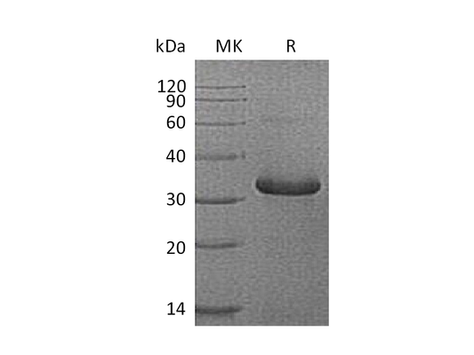 Recombinant Human IGFBP-1 (C-6His)