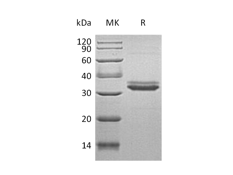 Recombinant Human IGFBP-4 (C-6His)