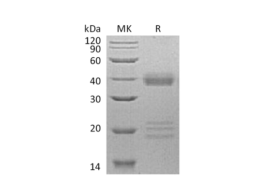 Recombinant Human IGFBP-5 (C-6His)