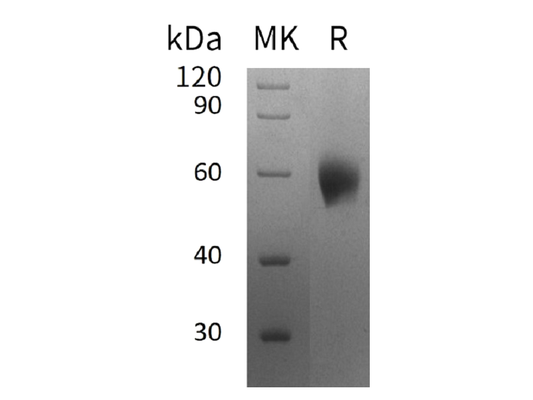 Recombinant Human IL-1RAcP (Q9NPH3-2, C-6His)