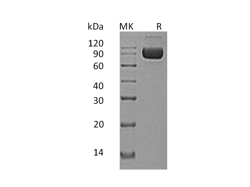 Recombinant Human IL-1RAcP (Q9NPH3-2, C-Fc-6His)