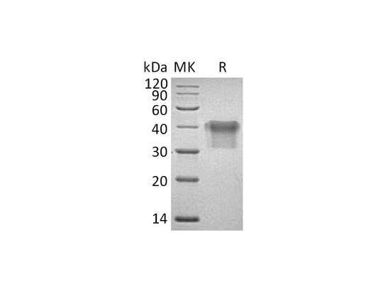 Recombinant Human IL-2RA (C-6His)