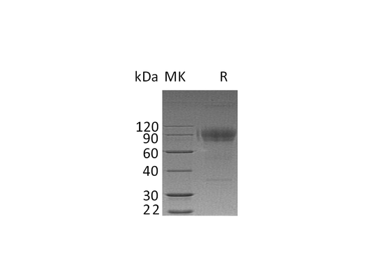 Recombinant Human IL-2RG (C-Fc)