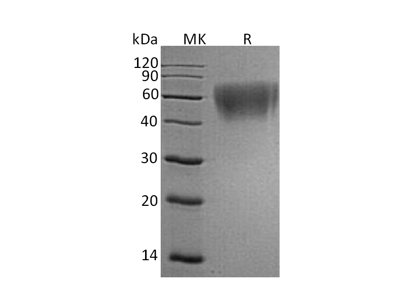 Recombinant Human ICOSLG (C-6His)