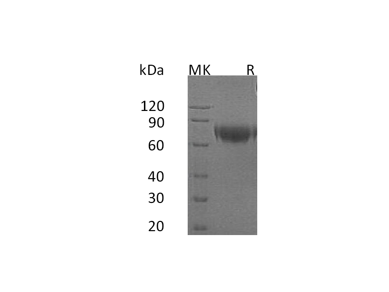 Recombinant Human IFNAR2 (C-Fc)