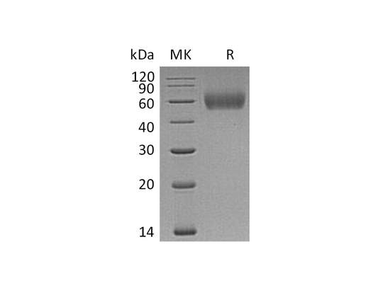 Recombinant Human IL-1R2 (C-6His)