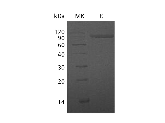 Recombinant Human IL-1R2 (C-Fc)