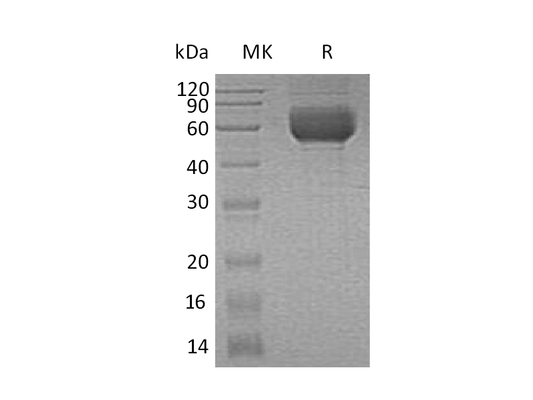 Recombinant Human ST2 (C-6His)