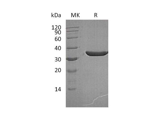 Recombinant Human KLK3 (236AA, C-6His)