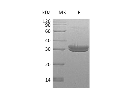 Recombinant Human KLK7 (C-6His)