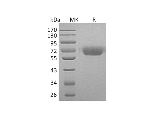Recombinant Human KNG1 (C-6His)
