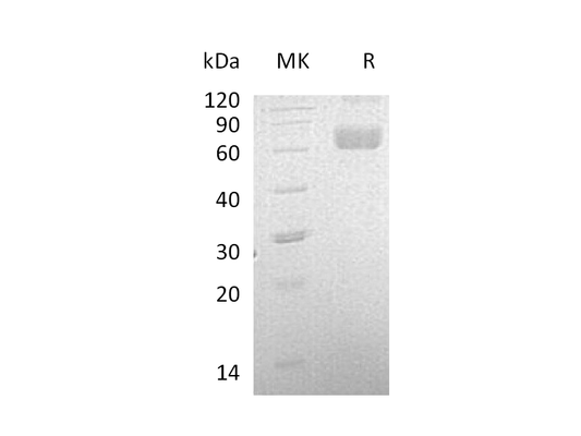 Recombinant Human LCAT (C-6His)