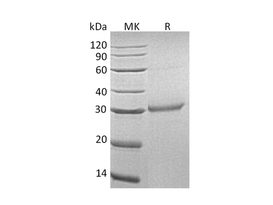 Recombinant Human OLR1 (C-6His)