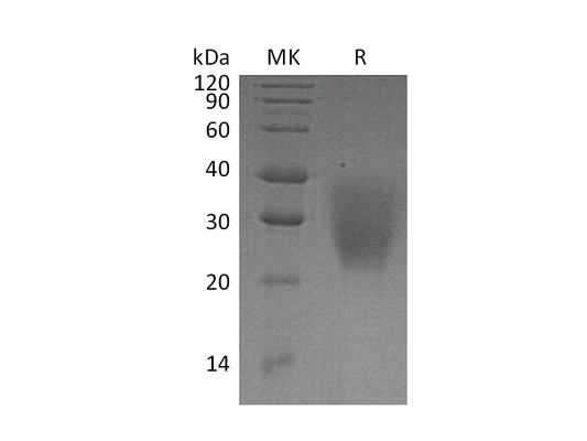 Recombinant Human LRRC25 (C-6His)