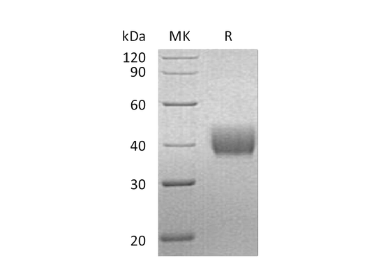 Recombinant Human Mesothelin (C-6His)
