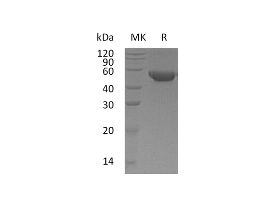 Recombinant Human MGAT2 (C-6His)